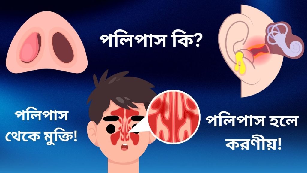 পলিপাস