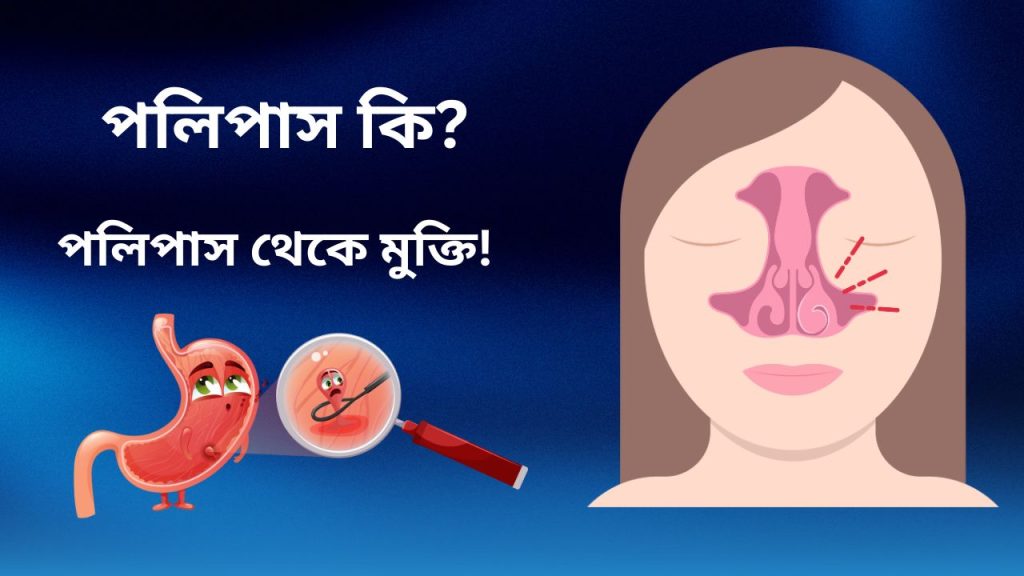 পলিপাস থেকে মুক্তি পাওয়ার উপায়