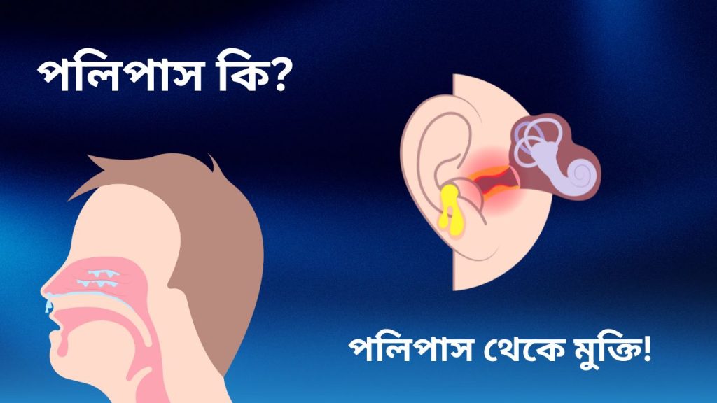 পলিপাস হলে করণীয়